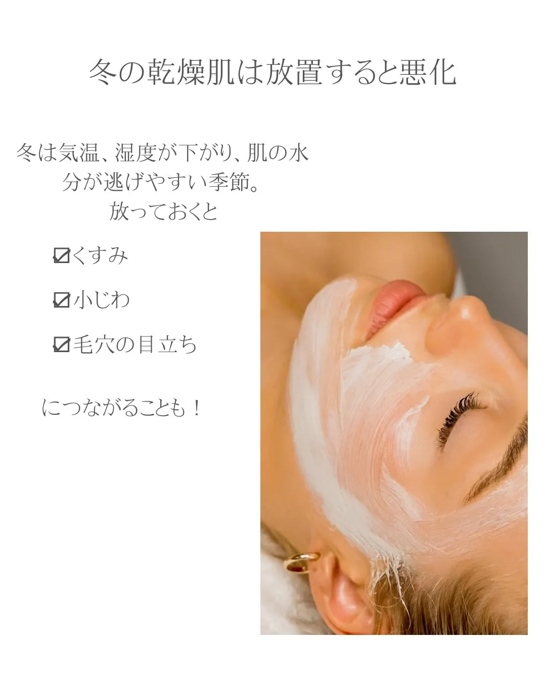 冬の乾燥肌チェックリスト