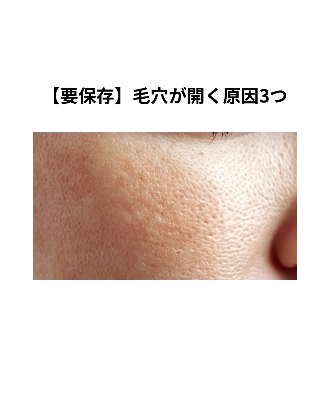 【毛穴が開く原因3つ】