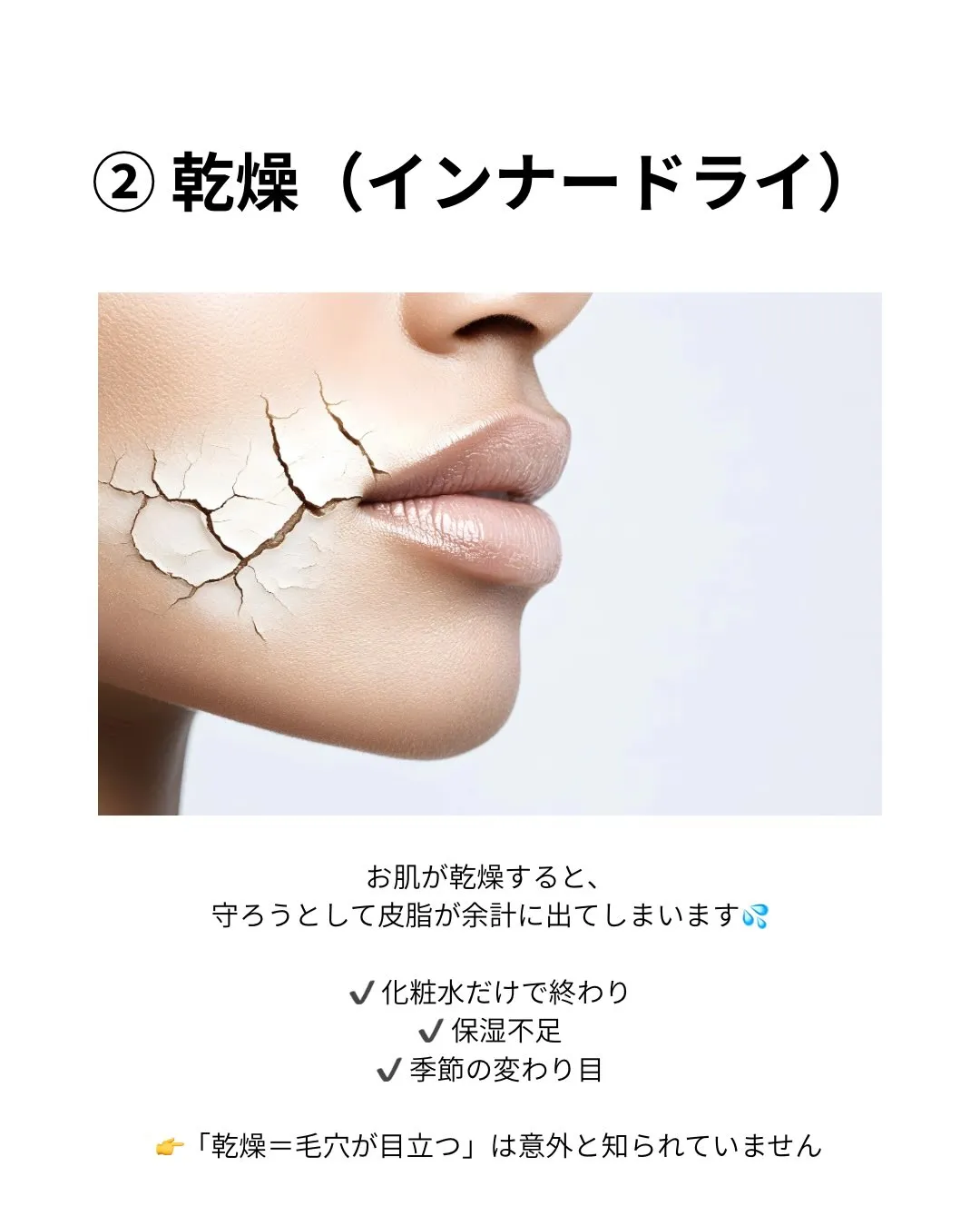 【毛穴が開く原因3つ】