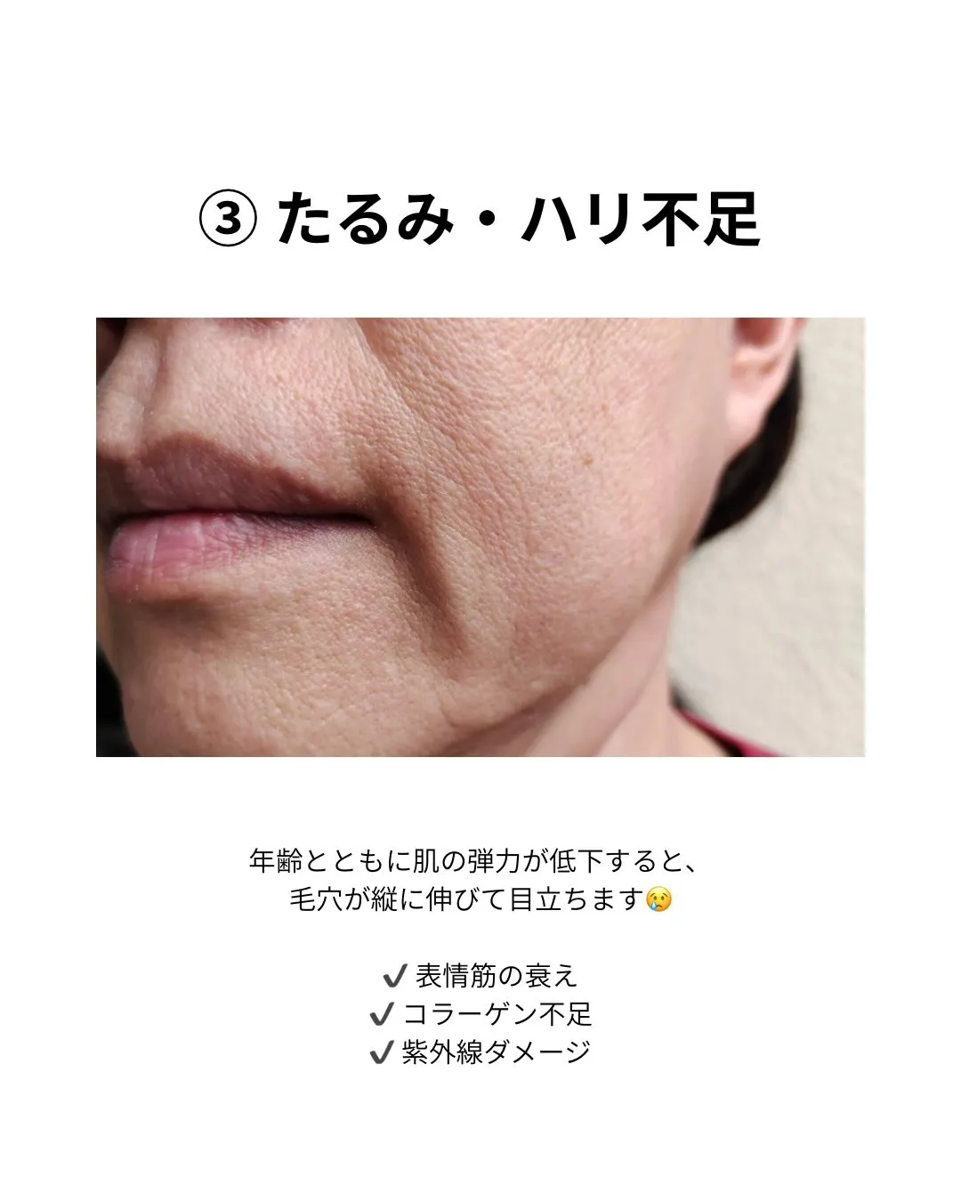 【毛穴が開く原因3つ】