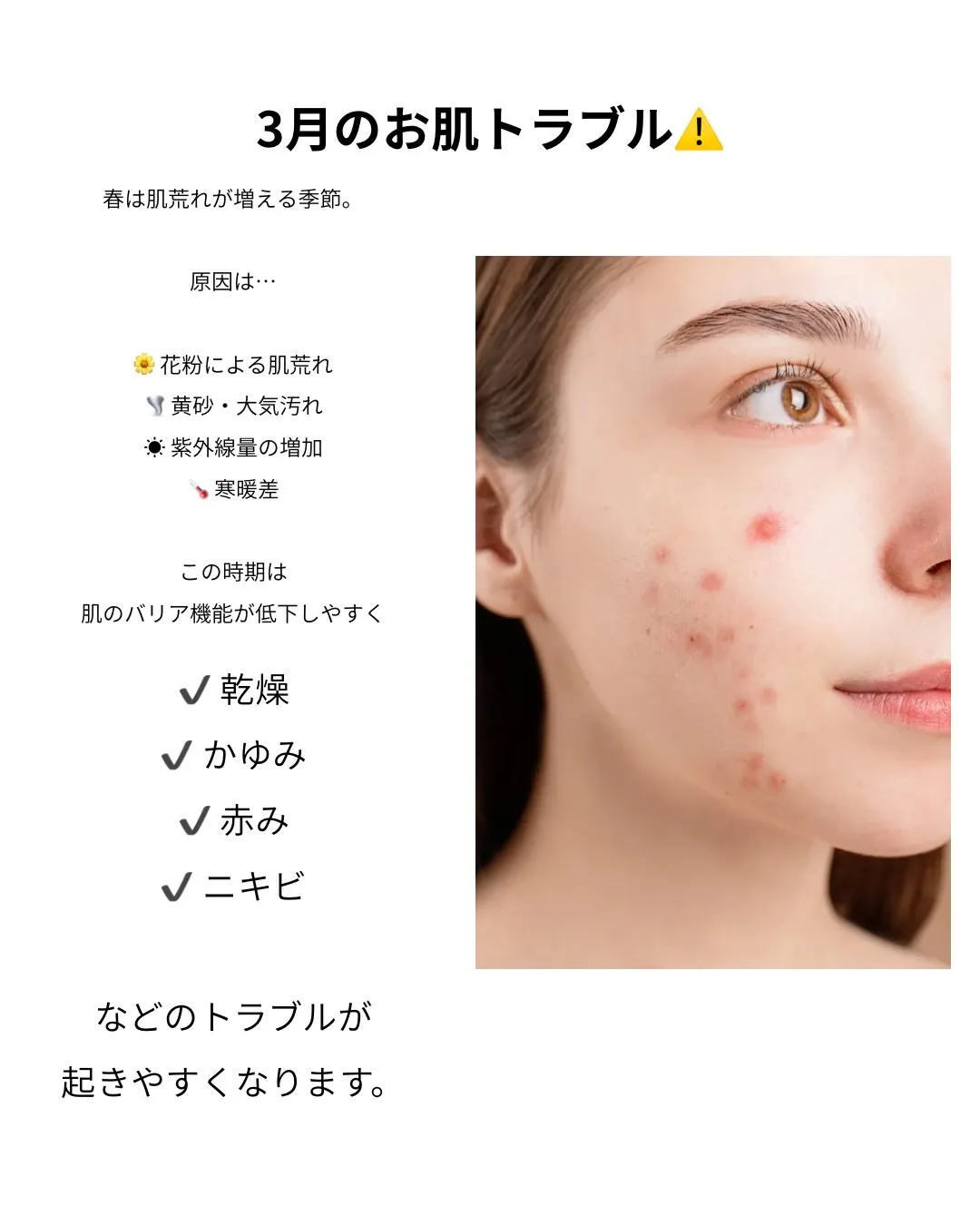 3月、お肌が急に荒れていませんか？