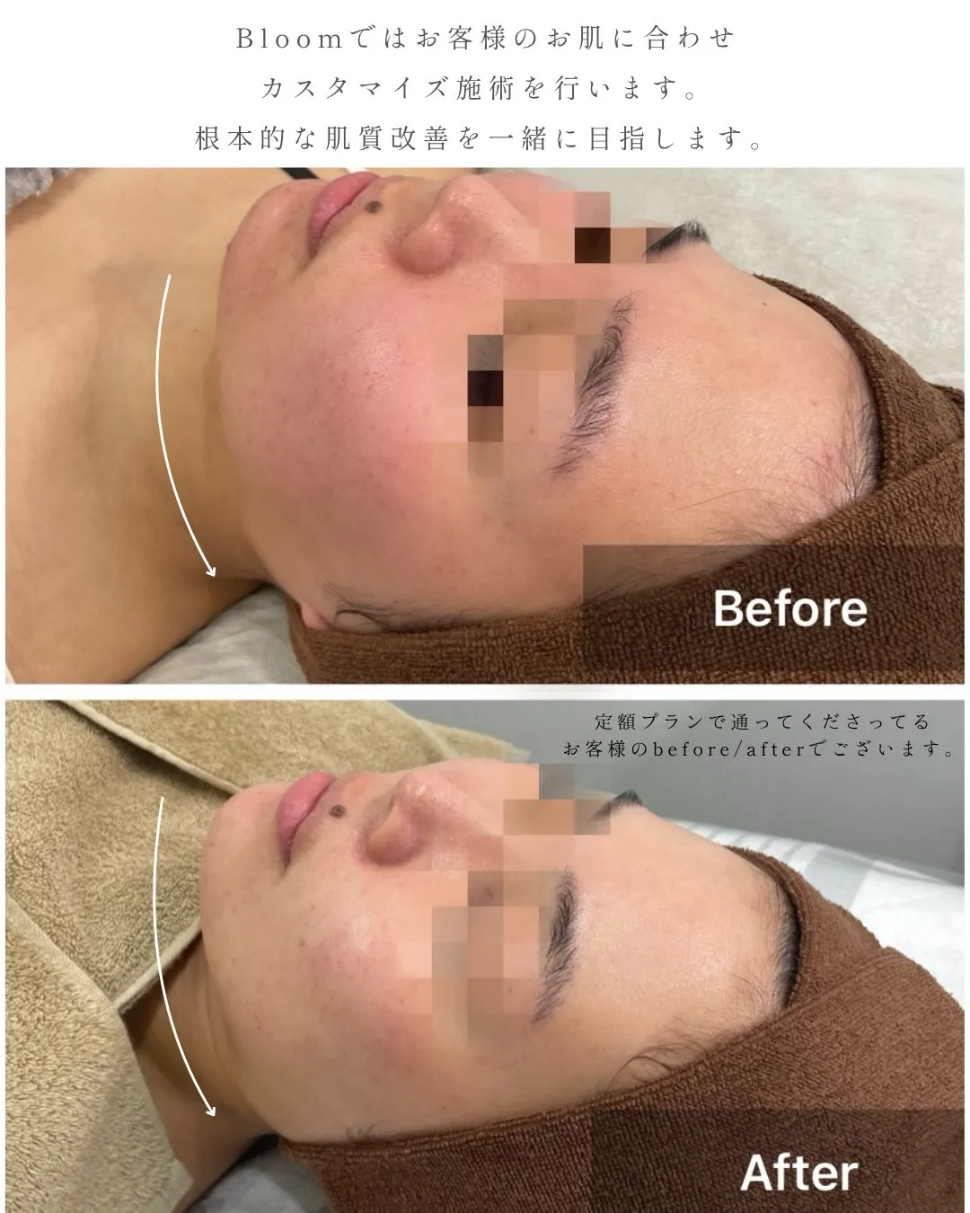 定額プランに通って下さってるお客様の変化です😌🫧✨